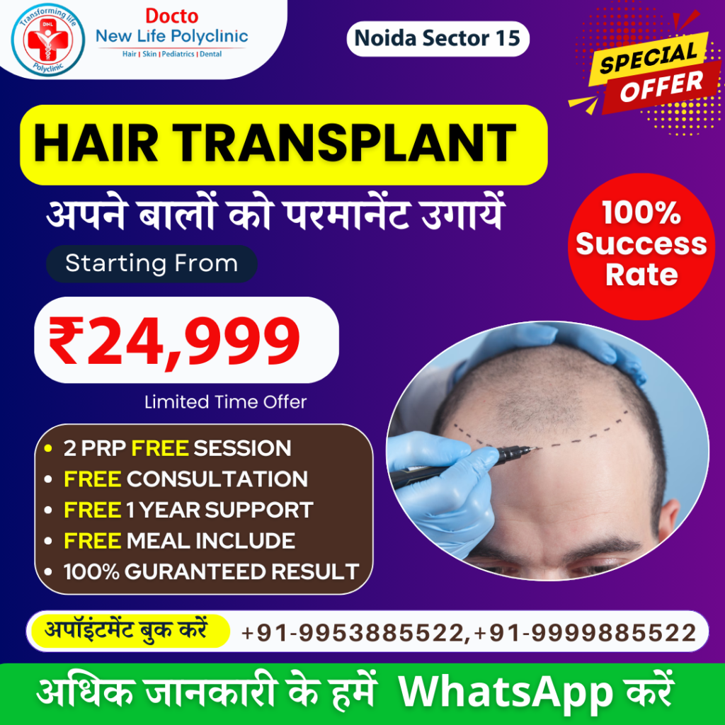 Best Hair Transplant in Noida