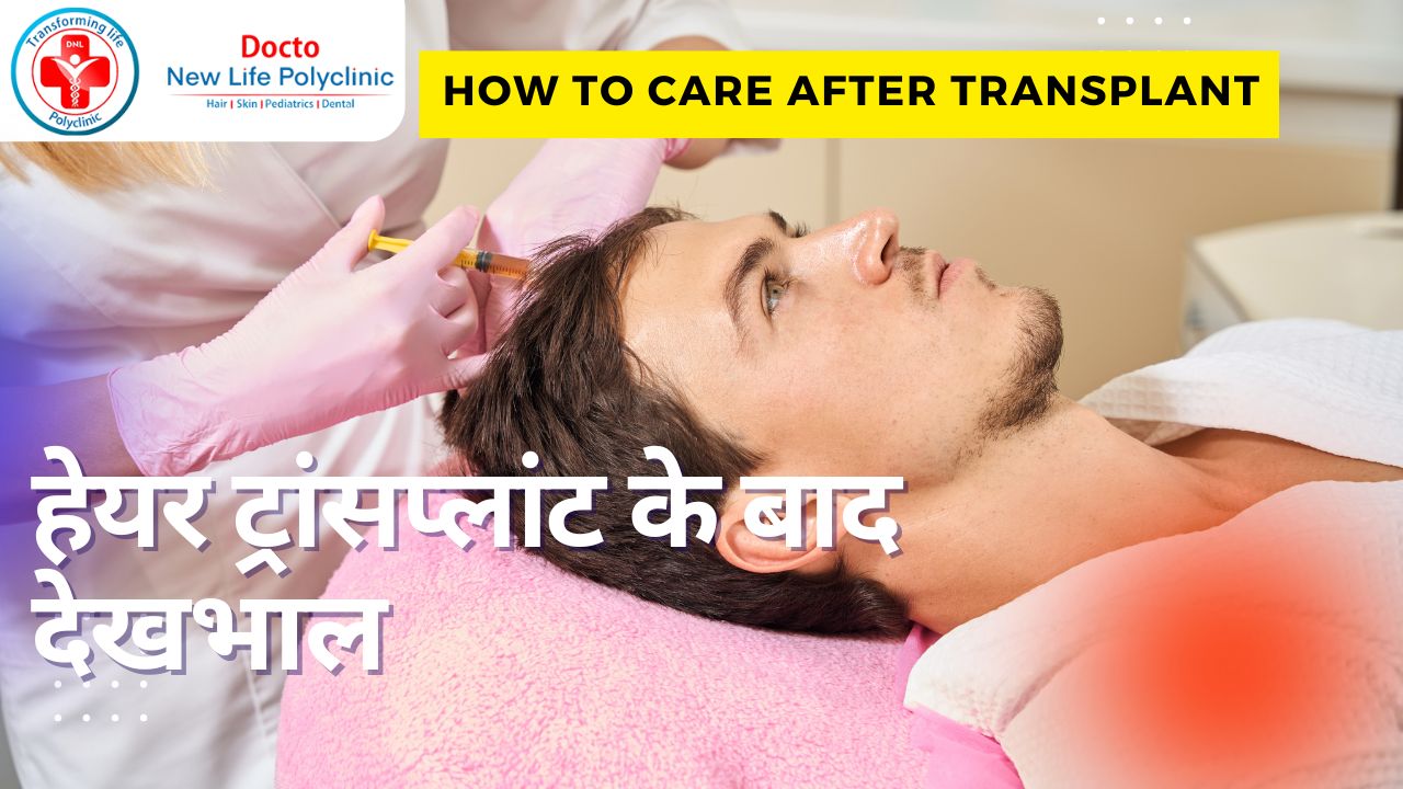 हेयर ट्रांसप्लांट के बाद देखभाल – How to care your hair transplant